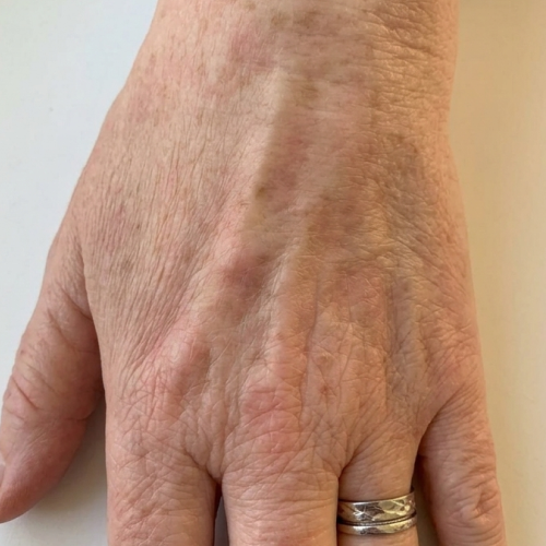 After - Carol, 64