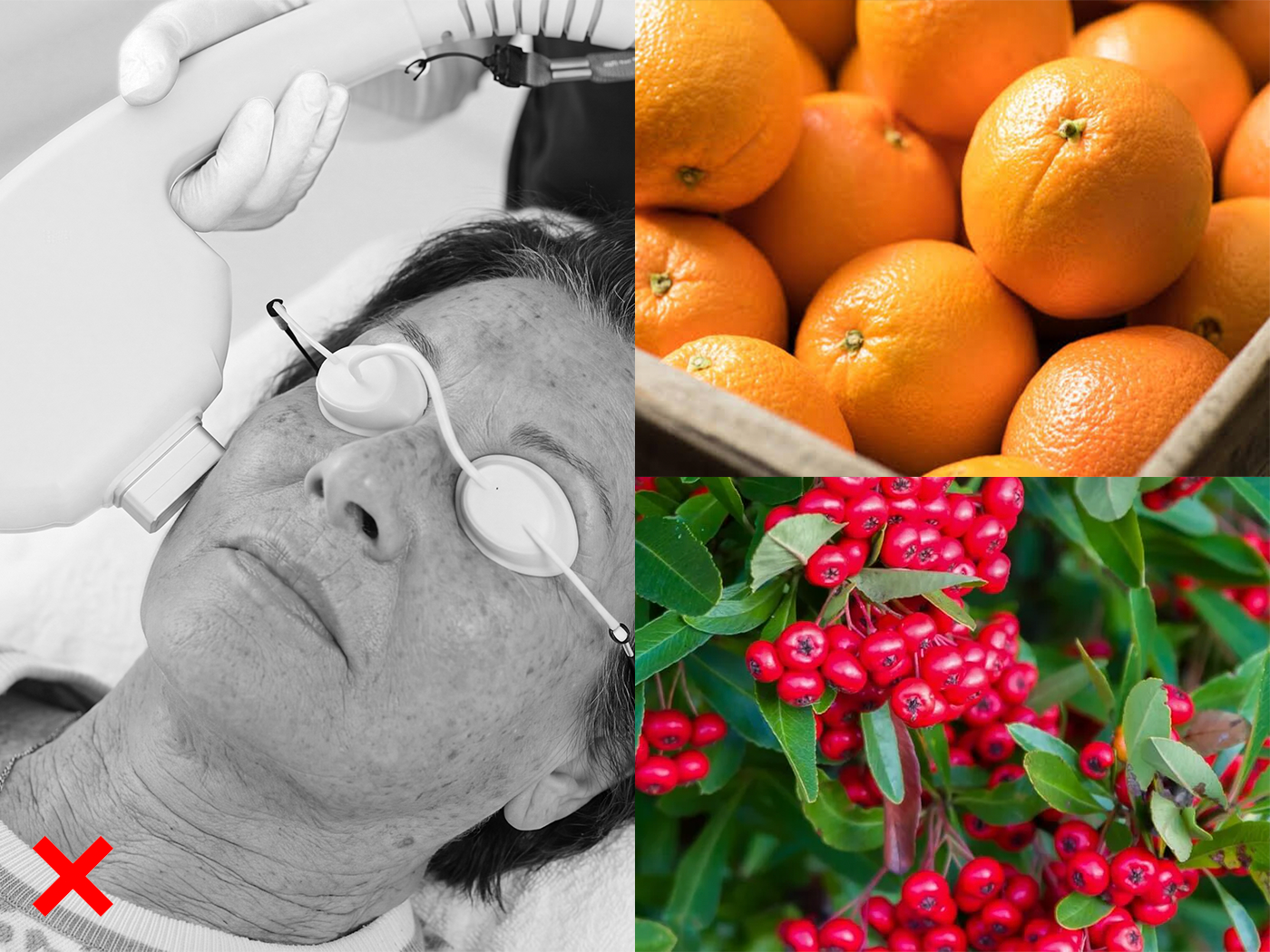 Alpha arbutin and vitamin C