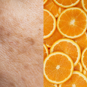 Ascorbic acid (Vitamin C)